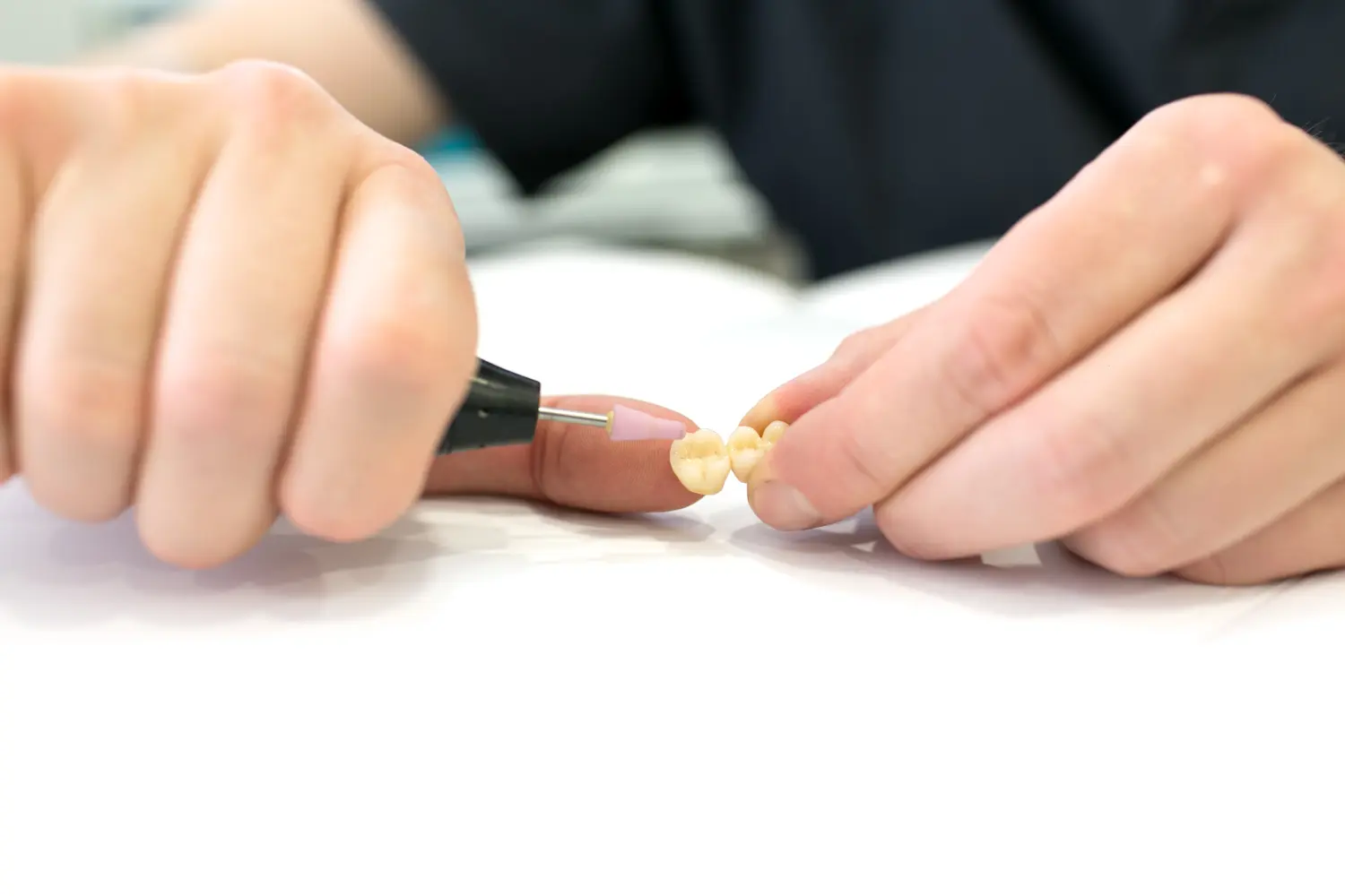 Veneers & Smile Design